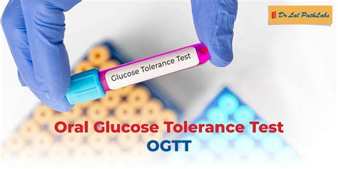 oral glucose tolerance test reviews